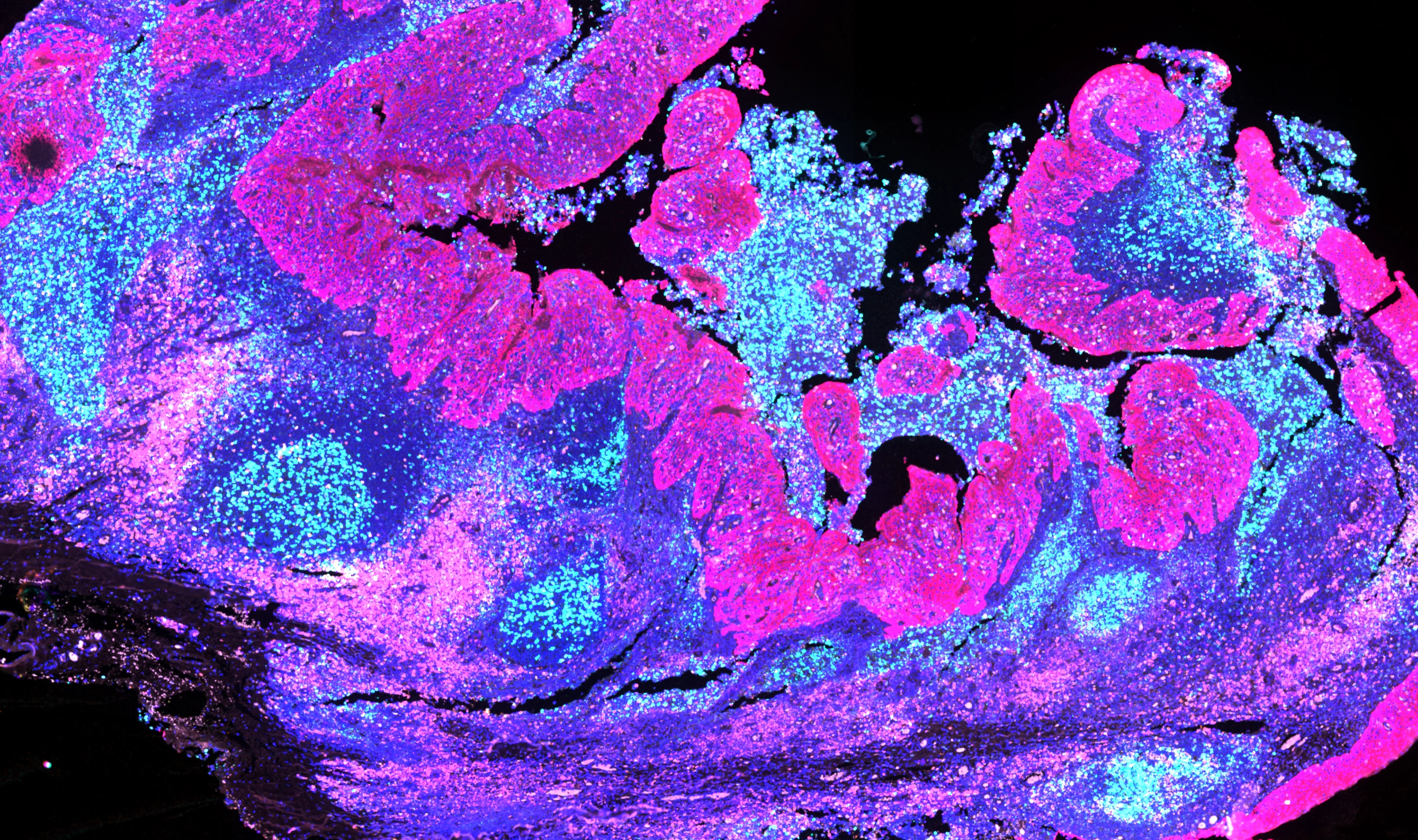 mIF Whole Slide Image